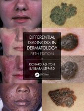 book Differential Diagnosis in Dermatology, 5th Edition