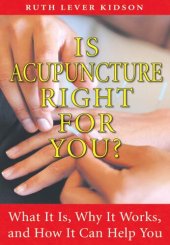 book Is Acupuncture Right for You?: What It Is, Why It Works, and How It Can Help You