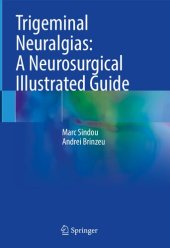 book Trigeminal Neuralgias: A Neurosurgical Illustrated Guide