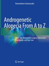 book Androgenetic Alopecia From A to Z: Vol.3 Hair Restoration Surgery, Alternative Treatments, and Hair Care