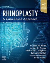 book Rhinoplasty: A Case-Based Approach