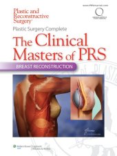 book Plastic Surgery Complete: The Clinical Masters of PRS: Breast Reconstruction