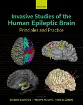 book Invasive Studies of the Human Epileptic Brain: Principles and Practice