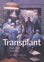 book Transplant: From Myth to Reality