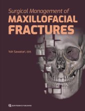 book Surgical Management of Maxillofacial Fractures