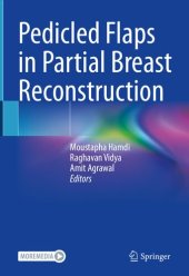 book Pedicled Flaps in Partial Breast Reconstruction