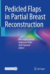 book Pedicled Flaps in Partial Breast Reconstruction