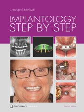 book Implantology Step by Step