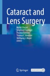 book Cataract and Lens Surgery