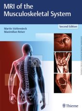 book MRI of the Musculoskeletal System