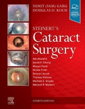 book Steinert's Cataract Surgery