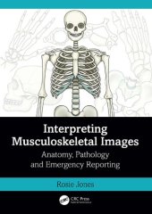 book Interpreting Musculoskeletal Images: Anatomy, Pathology and Emergency Reporting