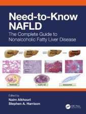 book Need-to-Know NAFLD: The Complete Guide to Nonalcoholic Fatty Liver Disease (by Team-IRA)