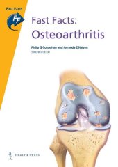 book Fat Facts: Osteoarthritis, second edition (Fast Facts)