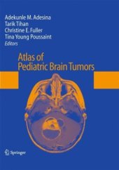 book Atlas of Pediatric Brain Tumors