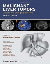 book Malignant Liver Tumors: Current and Emerging Therapies