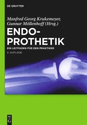 book Endoprothetik: Ein Leitfaden für den Praktiker