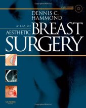 book Atlas of Aesthetic Breast Surgery