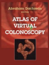 book Atlas of Virtual Colonoscopy