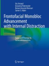 book Frontofacial Monobloc Advancement with Internal Distraction: Tactics and Strategy in Faciocraniosynostosis