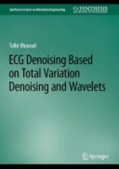 book ECG Denoising Based on Total Variation Denoising and Wavelets