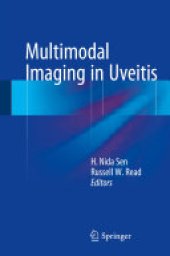 book Multimodal Imaging in Uveitis