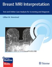 book Breast MRI Interpretation Text and Case Analysis for Screening and Diagnosis