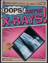 book Oops! They're X-Rays!