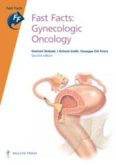 book Fast Facts: Gynecologic Oncology