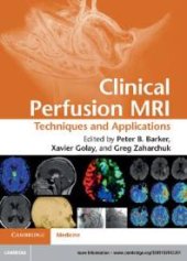 book Clinical Perfusion MRI : Techniques and Applications