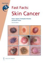 book Fast Facts: Skin Cancer : Skin Cancer