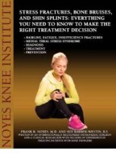 book Stress Fractures, Bone Bruises, and Shin Splints : Everything You Need to Know to Make the Right Treatment Decision