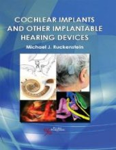 book Cochlear Implants and Other Implantable Hearing Devices