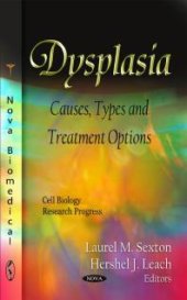 book Dysplasia: Causes, Types and Treatment Options : Causes, Types and Treatment Options