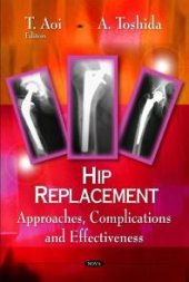 book Hip Replacement : Approaches, Complications and Effectiveness