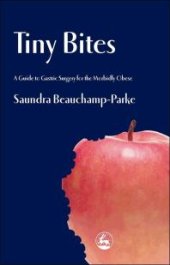 book Tiny Bites : A Guide to Gastric Surgery for the Morbidly Obese