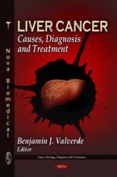 book Liver Cancer: Causes, Diagnosis and Treatment : Causes, Diagnosis and Treatment