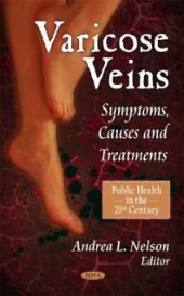 book Varicose Veins: Symptoms, Causes and Treatments : Symptoms, Causes and Treatments