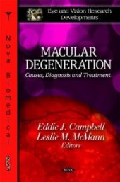 book Macular Degeneration: Causes, Diagnosis and Treatment : Causes, Diagnosis and Treatment