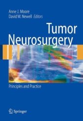 book Tumor Neurosurgery: Principles and Practice 