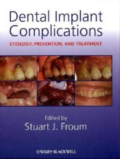 book Dental Implant Complications: Etiology, Prevention, and Treatment