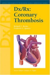 book Dx/Rx Coronary Thrombosis 