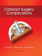 book Cataract Surgery Complications