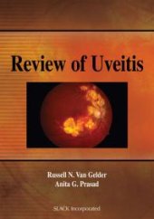 book Review of Uveitis