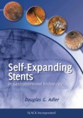 book Self-Expanding Stents in Gastroenterology