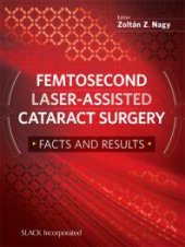 book Femtosecond Laser-Assisted Cataract Surgery : Facts and Results