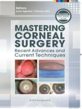 book Mastering Corneal Surgery : Recent Advances and Current Techniques