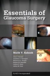 book Essentials of Glaucoma Surgery