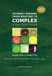 book Cataract Surgery from Routine to Complex : A Practical Guide