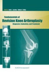 book Fundamentals of Revision Knee Arthroplasty : Diagnosis, Evaluation, and Treatment